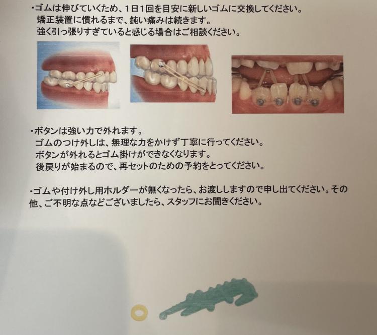 	インビザライン・マウスピース矯正　14枚目