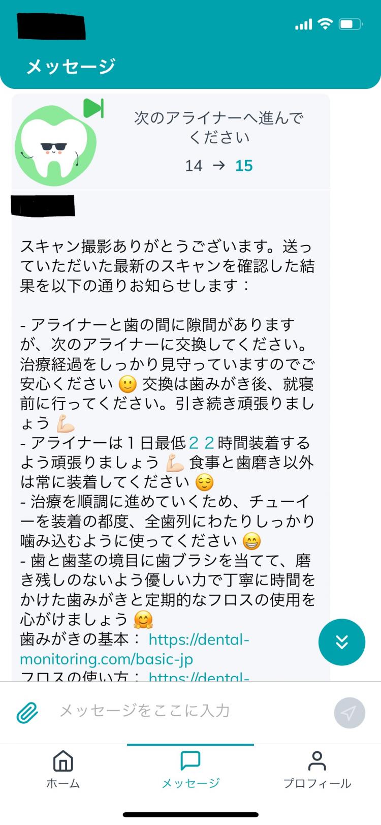 インビザライン・マウスピース矯正　15枚目