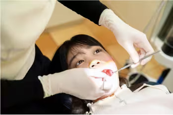 矯正治療スタート